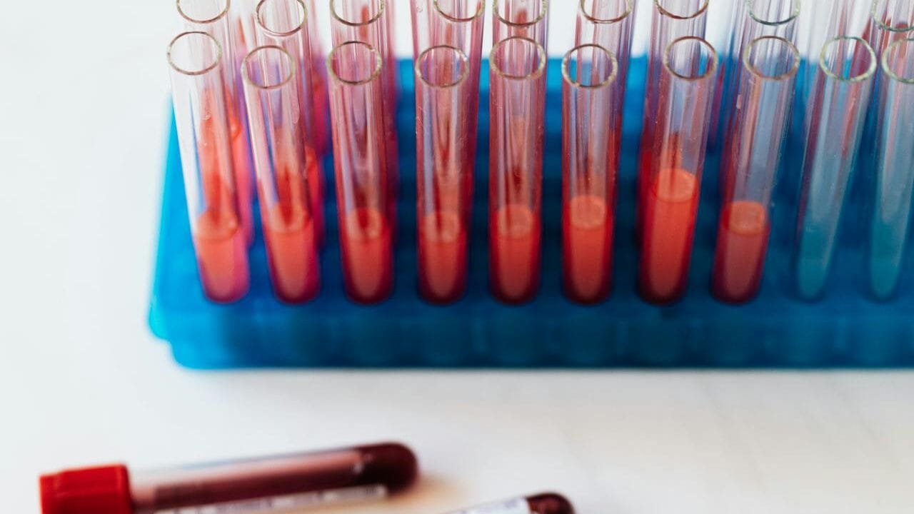 blood test