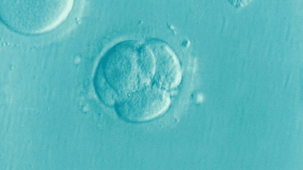Frozen Embryo Transfer