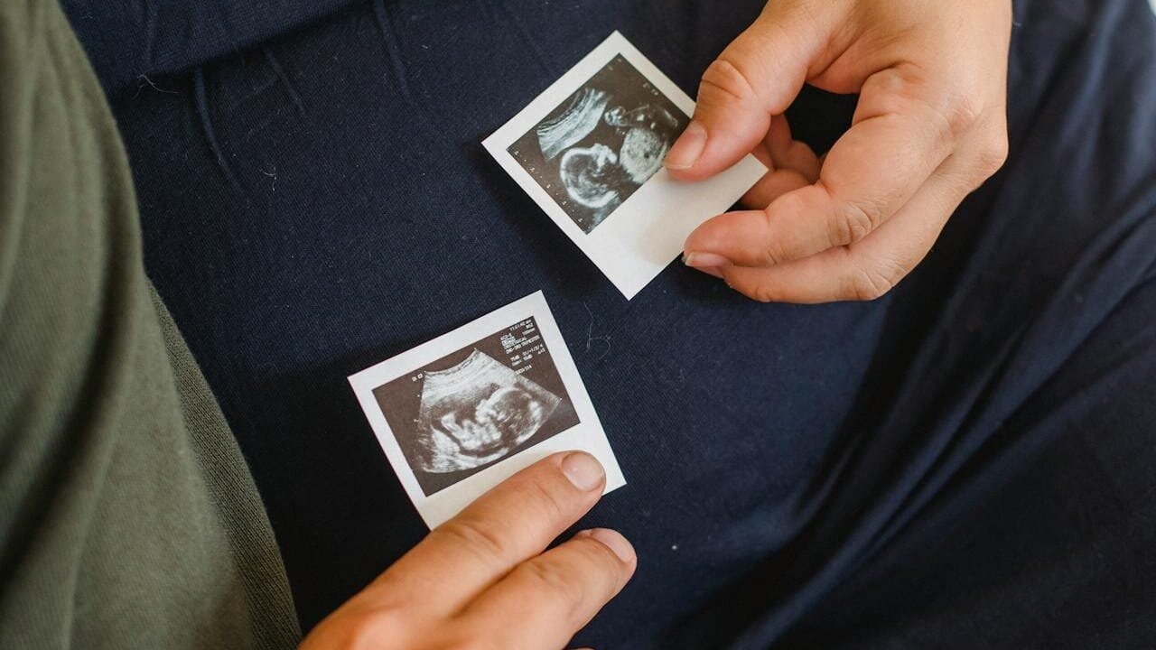 A pregnant person holding ultrasound photos of their baby.