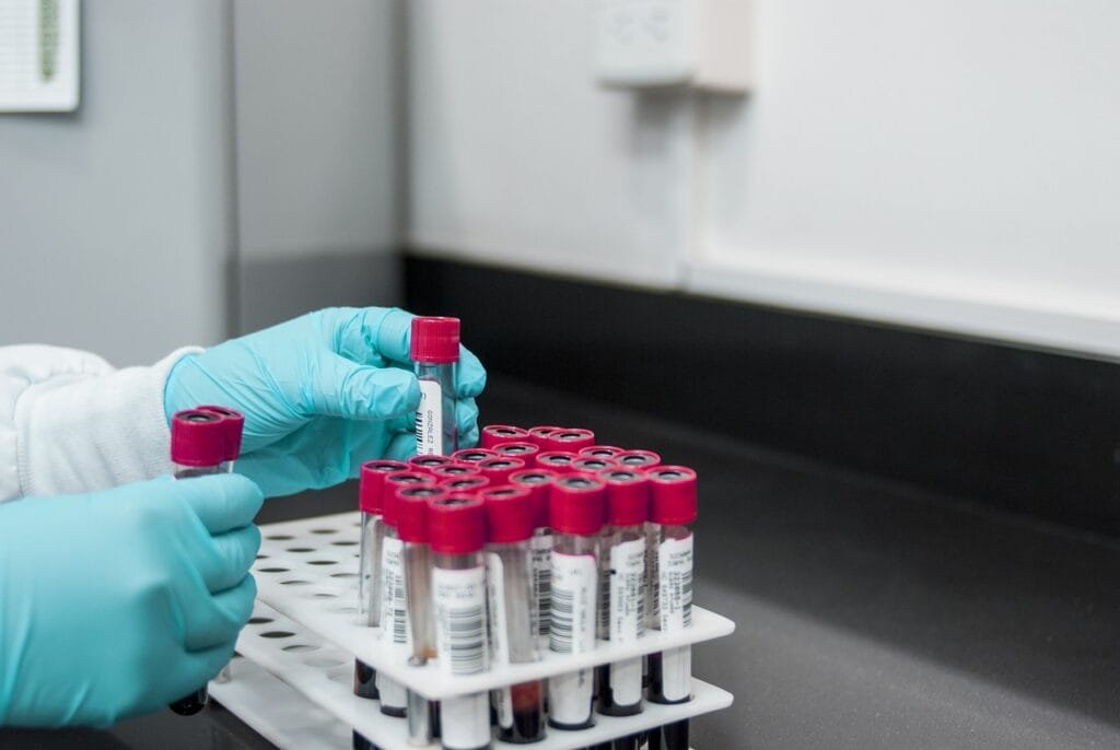 Blood test