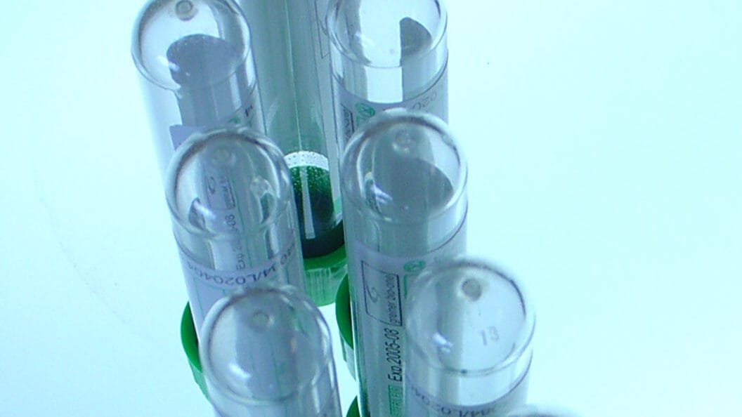 A close-up photograph of several test tubes or vials with green caps.